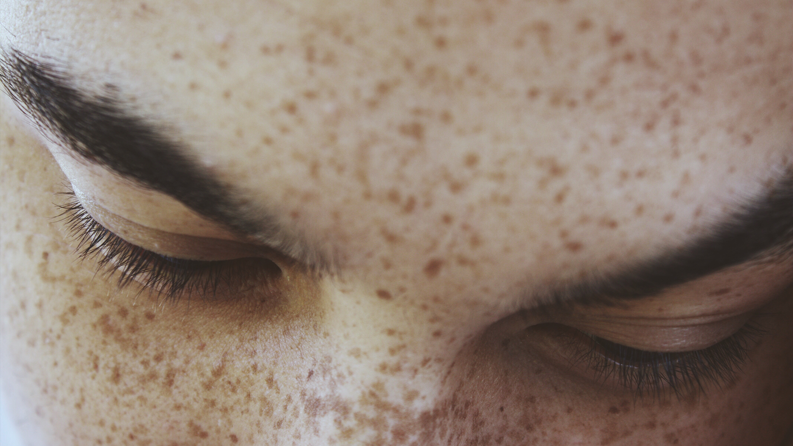 brf_warumdarum_sommersprossen